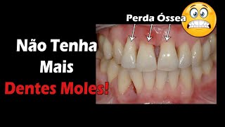 Não Tenha Mais Dentes Moles  3 Dicas FÁCEIS E RÁPIDAS  Periodontite Tem Cura [upl. by Eiznik]