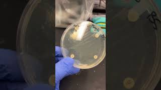 Antibiotic test on Pseudomonas A which anti biotic worked best  microorganisms antibiotics [upl. by Nelson]