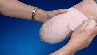 Wrapping Technique BK Residual Limb  Springer Prosthetic amp Orthotics Services [upl. by Noellyn]