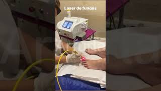 Arfurla laser nail fungus treatment equipment with 980nm 600um optical fiber toenail fungusremoval [upl. by Keane]