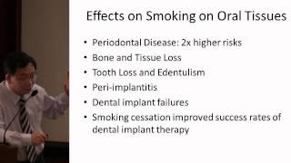 Dental Implants CPG Launch  Smoking and Dental Implants 1 of 3 [upl. by Ahsim]