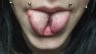 ◉ Tongue Split  Healing Process ◉ [upl. by Ssecnirp]