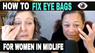 How To Fix Your Eye Bags For Women In Midlife [upl. by Cowen]