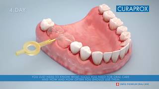 3D animation How to use an interdental brush correctly [upl. by Ahsaeit585]