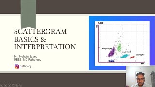 Scattergram Basics amp patterns in Leukemia leukemia bloodcancer cancer pathology hematology [upl. by Oika831]