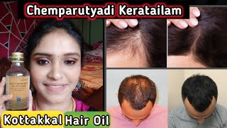 தமிழில் Kottakkal Chemparutyadi Keratailam Review  Hair growth Treatment  Seborrheic dermatitis [upl. by Kathe290]