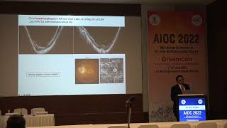 AIOC2022 IC2 topic Dr ATUL KUMAR When to and when not to operate in myopic tractional maculopathy [upl. by Jehoash]