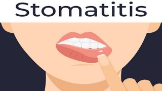 stomatitiscauses of stomatitissymptoms of stomatitisshort [upl. by Frasier]