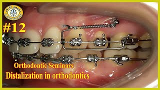 12 Distalization in orthodontics سيمينارات تقويم الأسنان جامعة الأزهر [upl. by Nosauq855]