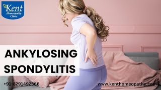 Ankylosing spondylitisरीढ़ के जोड़ों में गतिविधिरोधक सूजन [upl. by Natfa629]