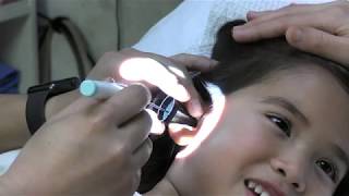 Awake Ear Tube Placement In Children [upl. by Dal]