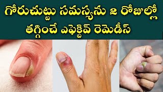 Effective Home Remedies for Nail Fungus  How to Prevent and Treat a Paronychia  Goru Chuttu [upl. by Avitzur]