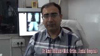 Benefits of Total Knee Replacement  Dr Amit Bhutani Hindi 720p HD [upl. by Mafala]