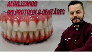 Acrilização de um protocolo dentário  mandíbular [upl. by Aloel]