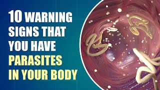 Dont Ignore These Early Symptoms of Parasites In Your Body [upl. by Oler]