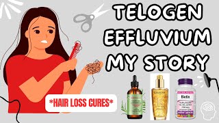 Telogen Effluvium Recovery  REGROWTH TIPS [upl. by Soisinoid]