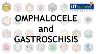 Omphalocele and Gastroschisis [upl. by Akili937]