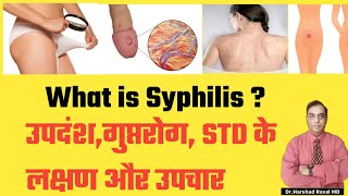 What is Syphilis । उपदंश गुप्तरोगSTD के लक्षण और उपचार l DrHarshad Raval MD Homeopath [upl. by Hubert]