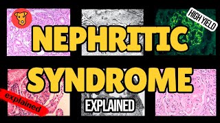 NEPHRITIC SYNDROME Pathogenesis of glomerular injury Mechanism of clinical symptoms USMLE Nephrology [upl. by Ahtanoj396]