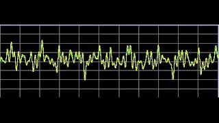 Mesothelioma  Rife Frequencies [upl. by Gulgee]