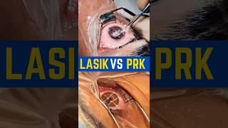 LASIK VS PRK [upl. by Moselle]