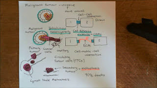 Cancer Development Part 3 [upl. by Amees]