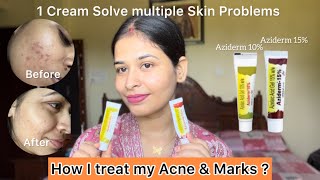 How to use Azelaic Acid correctly  Honest Review  All in One Cream [upl. by Hermosa]