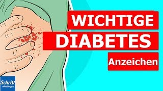 8 Anzeichen einer beginnenden Diabetes [upl. by Bortz]