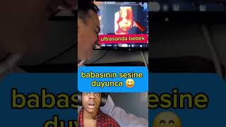 32 haftalık ultrasonda bebek babasının sesine gülümsüyor bebekvideoları cute baby babysmileatdad [upl. by Atsedom811]