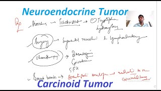 Carcinoid Tumor  Neuroendocrine Tumor  General Surgery Lectures  MBBS MS DNB MRCS  MCh Urology [upl. by Maurice]