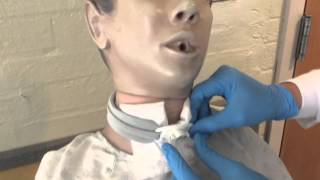 Trach Inner Cannula [upl. by Coffin]