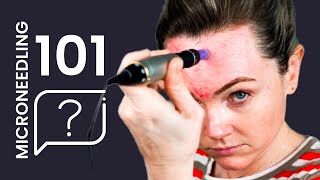 How to MICRONEEDLE 101 Answering Microneedling Pen Questions [upl. by Malynda]