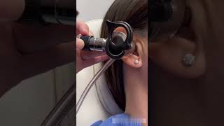 How an ENT Doctor Removes Ear Wax [upl. by Barbaraanne]