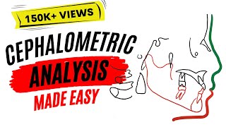 Cephalometric analysis [upl. by Lovash323]