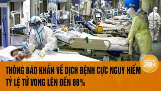 Vấn đề hôm nay Thông báo khẩn về dịch bệnh cực nguy hiểm tỷ lệ tử vong lên đến 88 [upl. by Corrina]