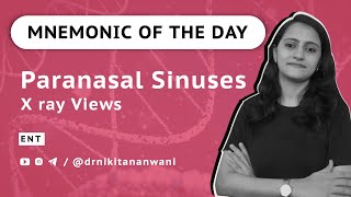 Paranasal Sinuses Mnemonics – X ray Views – Easy Story  ENT  NEETPG  USMLE  Dr Nikita Nanwani [upl. by Adnirol]