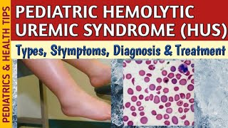 Hemolytic Uremic Syndrome HUS Symptoms Diagnosis amp Treatment In Children [upl. by Giffard]