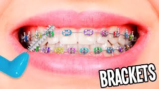 11 TRUCOS PARA QUIENES TIENEN BRACKETS ❤️ Tutoriales belen [upl. by Lucrece]