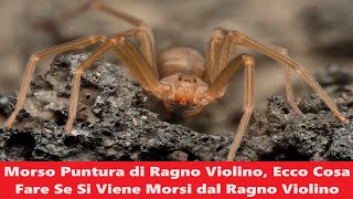 Morso Puntura di Ragno Violino Ecco Cosa Fare Se Si Viene Morsi dal Ragno Violino [upl. by Mandych667]