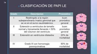 ANATOMIA CEREBRAL Y ECOGRAFIA TRANSFONTANELAR parte 2 [upl. by Fiorenza]