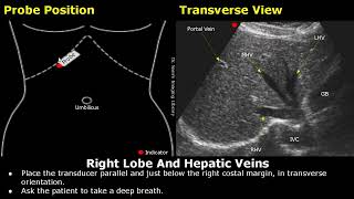 Liver Ultrasound Probe Positioning  Transducer Placement For Liver Scanning  Abdominal USG [upl. by Hardunn]