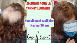 La solution idéale pour le manque de cheveux chez la femme  Complément Capillaire  explication [upl. by Yddet507]