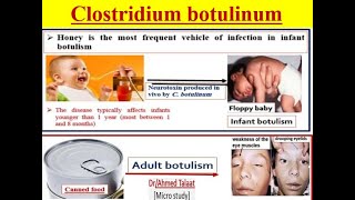 Clostridium botulinum Botulism disease quotMedical microbiology [upl. by Demha]