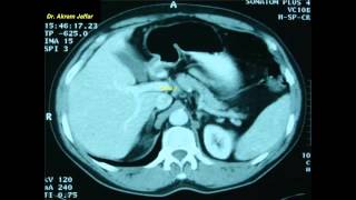 Cross sectional and imaging anatomy of the abdomen [upl. by Lucic156]