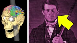 He Survived an Iron Rod Through His Brain — The Weird Story of Phineas Gage [upl. by Refenej924]