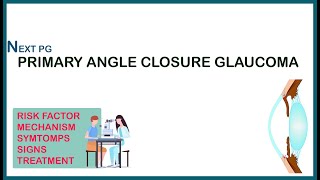 PRIMARY ANGLE CLOSURE GLAUCOMA  Ophthalmology lectures  NEET PG NOTES [upl. by Ahsimit35]