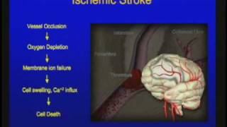 Vascular Disorders of the Central Nervous System [upl. by Wilhelmine761]