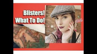 LaserAway Tattoo Removal What To Do If You Blister by CHERRY DOLLFACE [upl. by Remmus689]