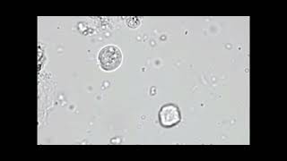 Trichomonas vaginalis  trichomoniasis urine Trichomonas in urine microscopy laboratory zee lab [upl. by Halac]