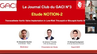 Journal Club du GACI n°3  Létude NOTION2 [upl. by Africa]